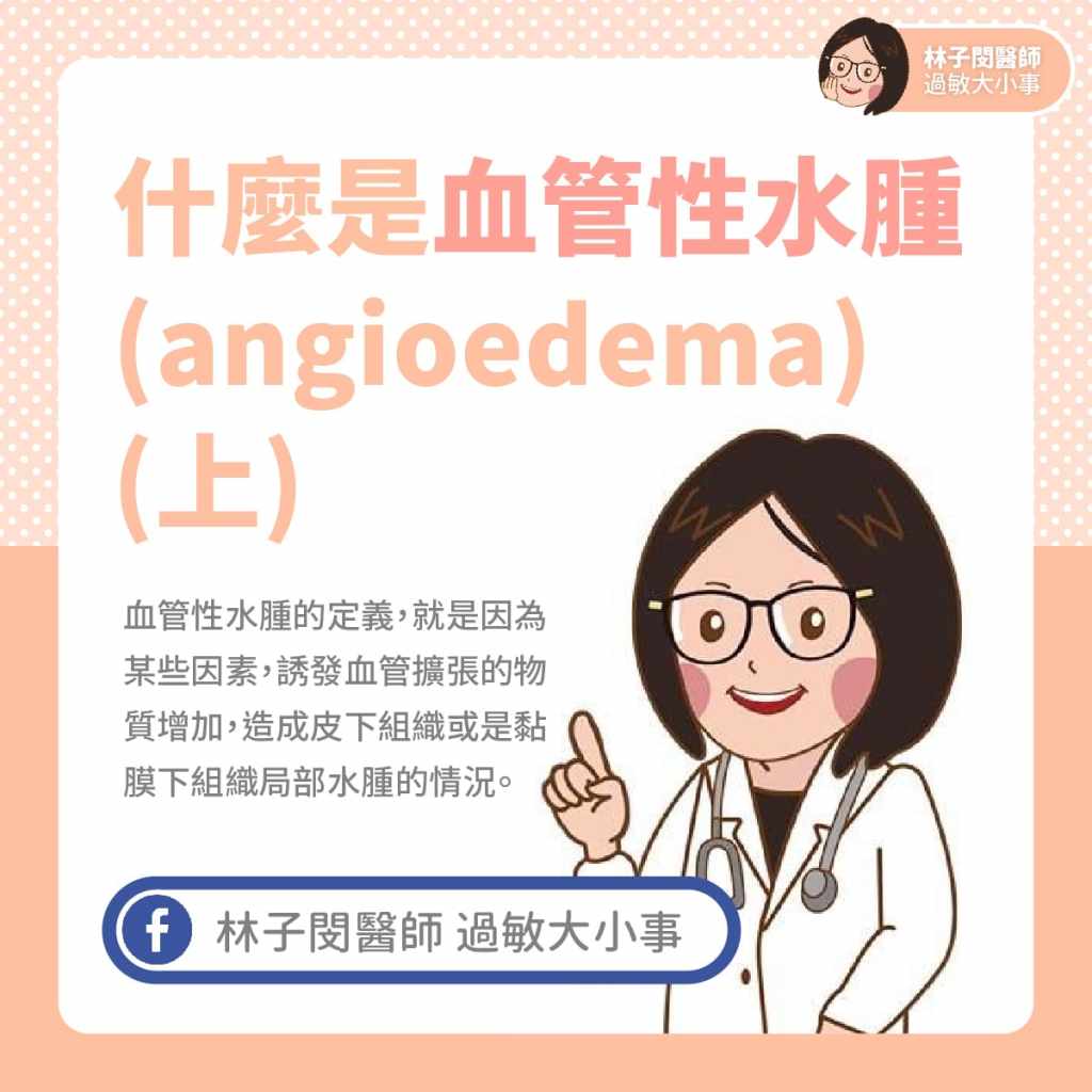 什麼是血管性水腫(angioedema) (上)