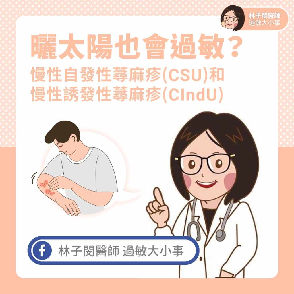 曬太陽也會過敏？慢性自發性蕁麻疹(CSU)和慢性誘發性蕁麻疹(CIndU)